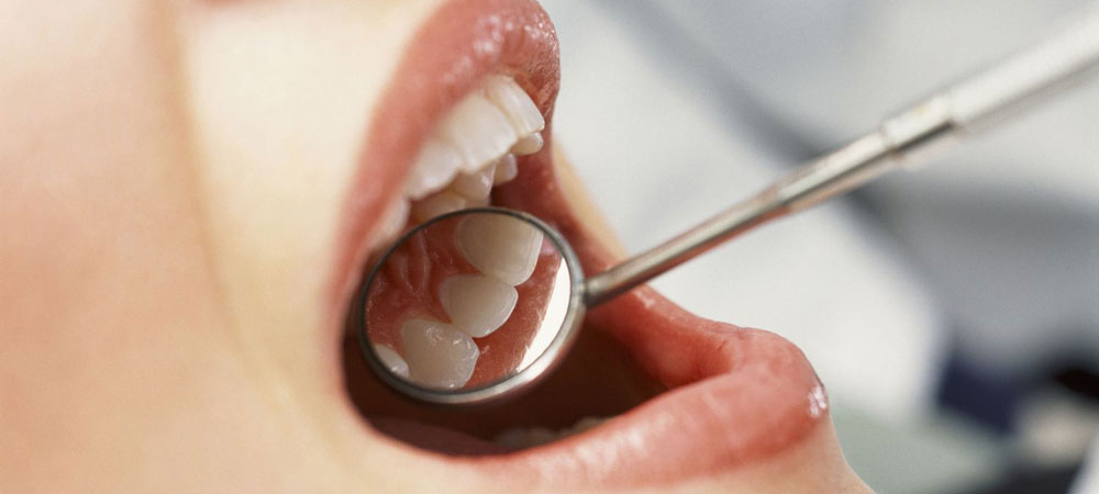Root Canal Treatment Near me at Gachibowli Root Canal Treatment Near me at Gachibowli